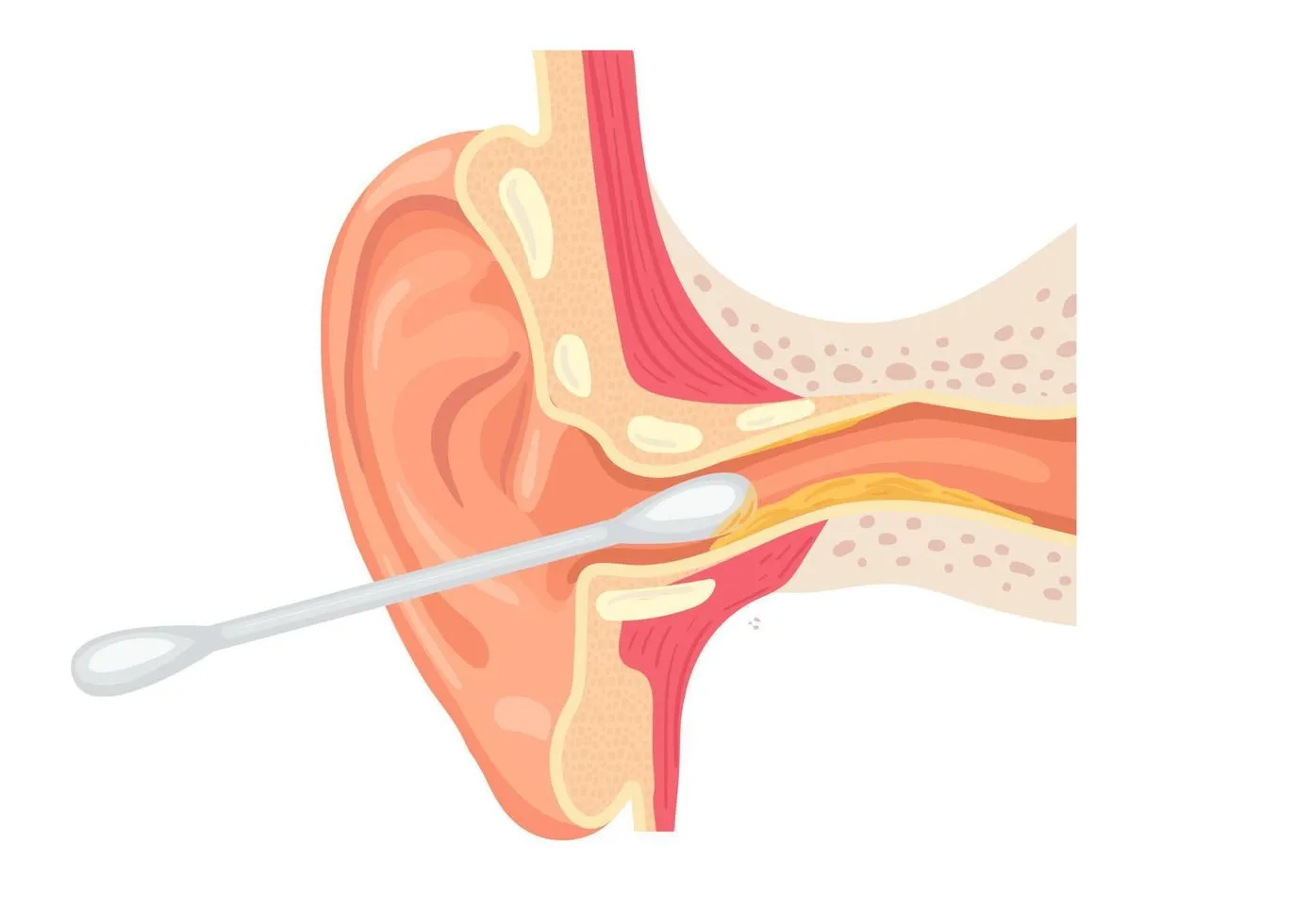 Mantén una buena higiene auricular